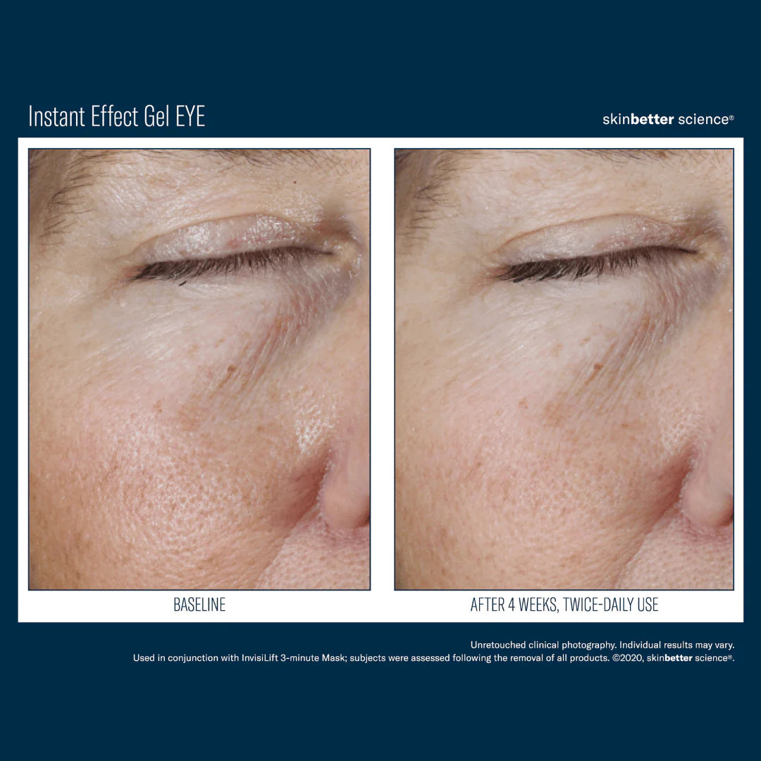 Instant Effect Gel EYE 15ml