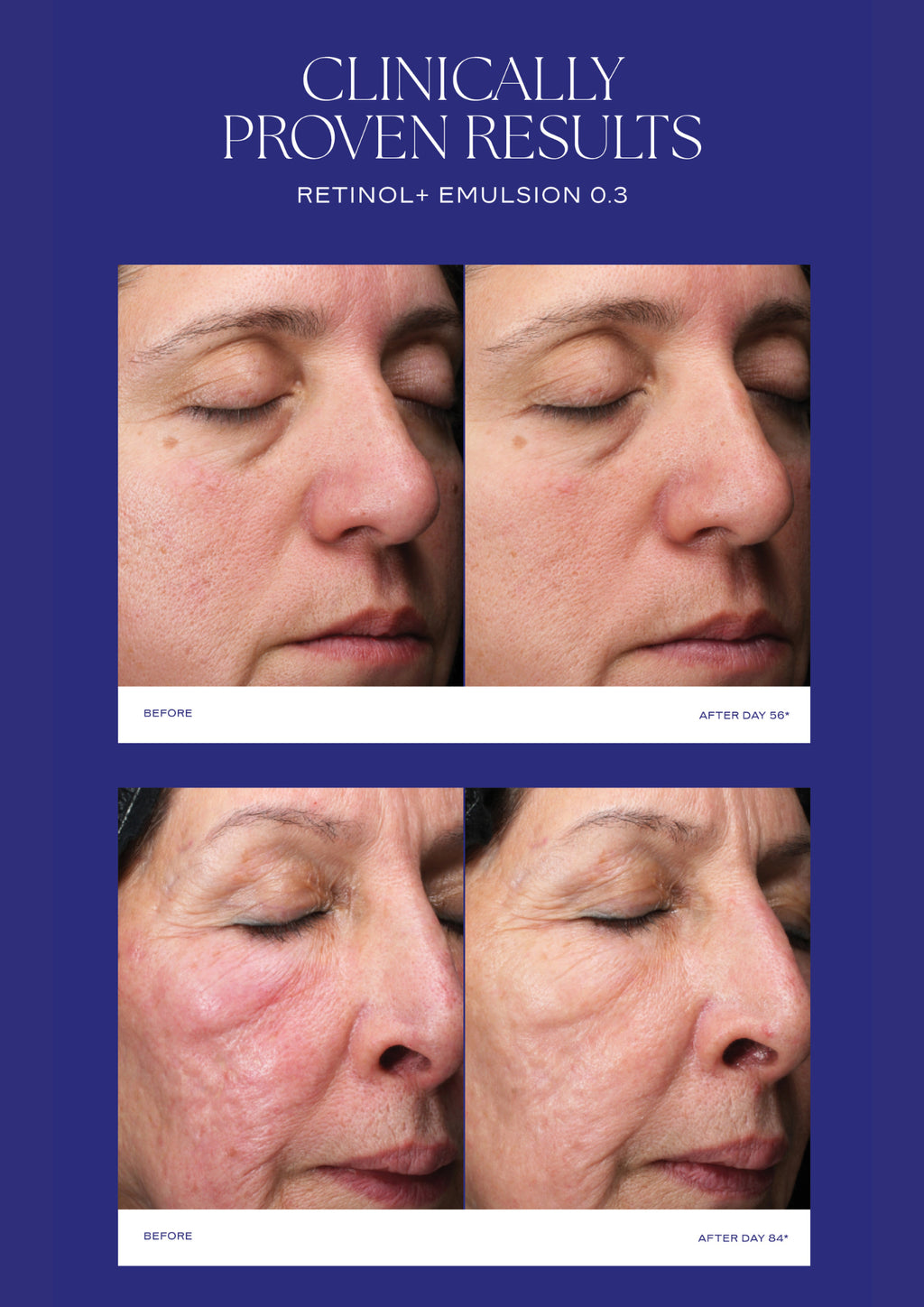Is Clinical  Retinol + Emulsion 0.3  30g
