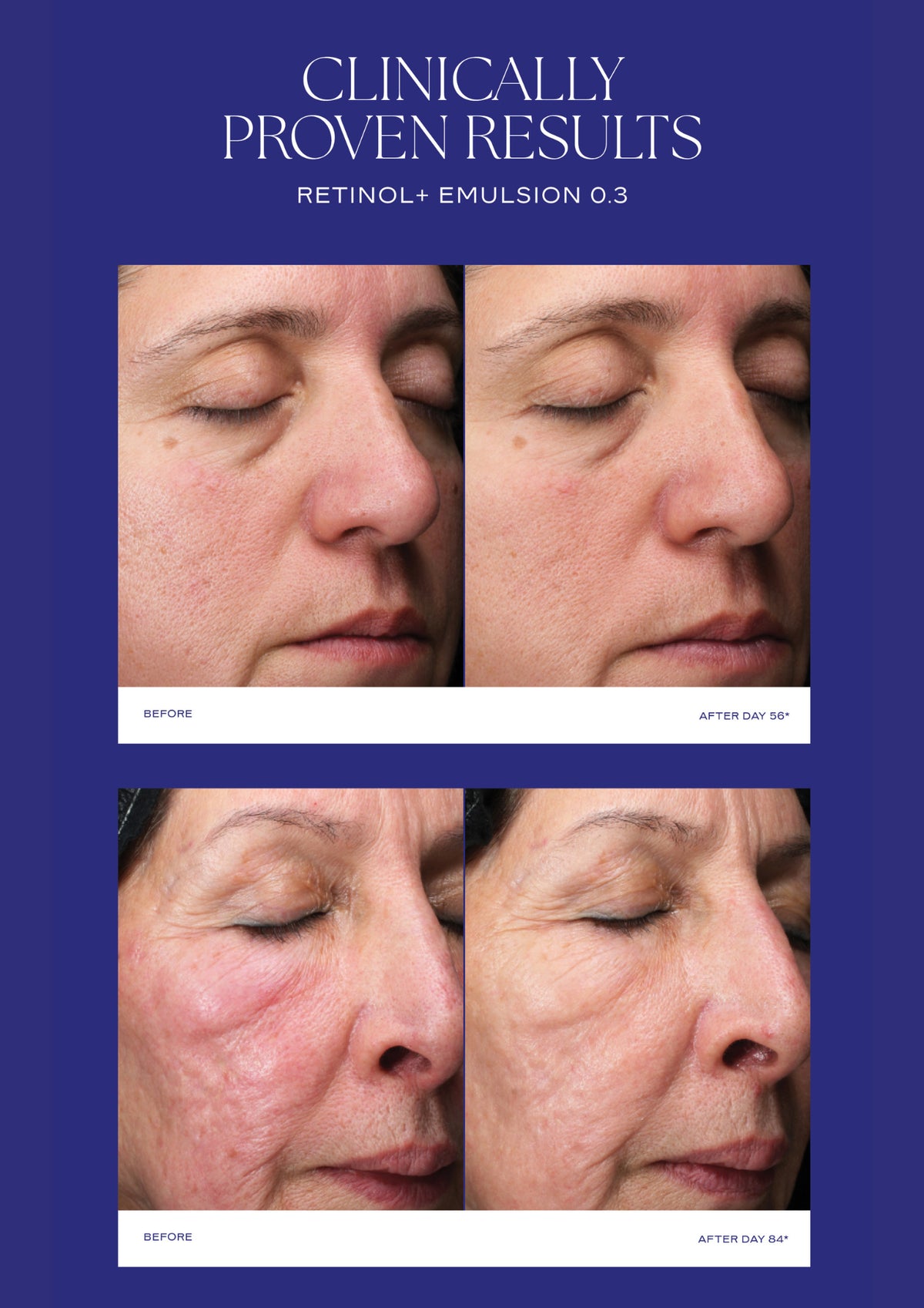 Is Clinical  Retinol + Emulsion 0.3  30g