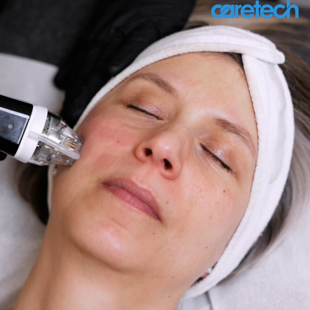 CARETECH_RADIANT_IMAGE_LOGOLLA_02